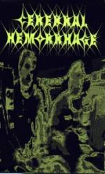 Cerebral Hemorrhage : Demo 1999 Cerebral Hemorrhage : Demo 1999